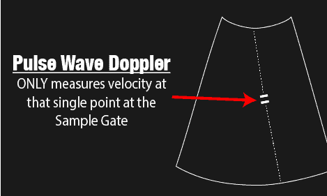 Pulse Wave Doppler Sample Gate