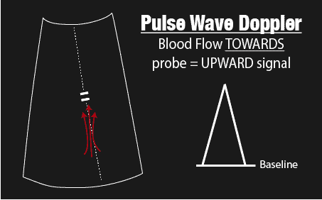 Pulse Wave Doppler Towards Probe