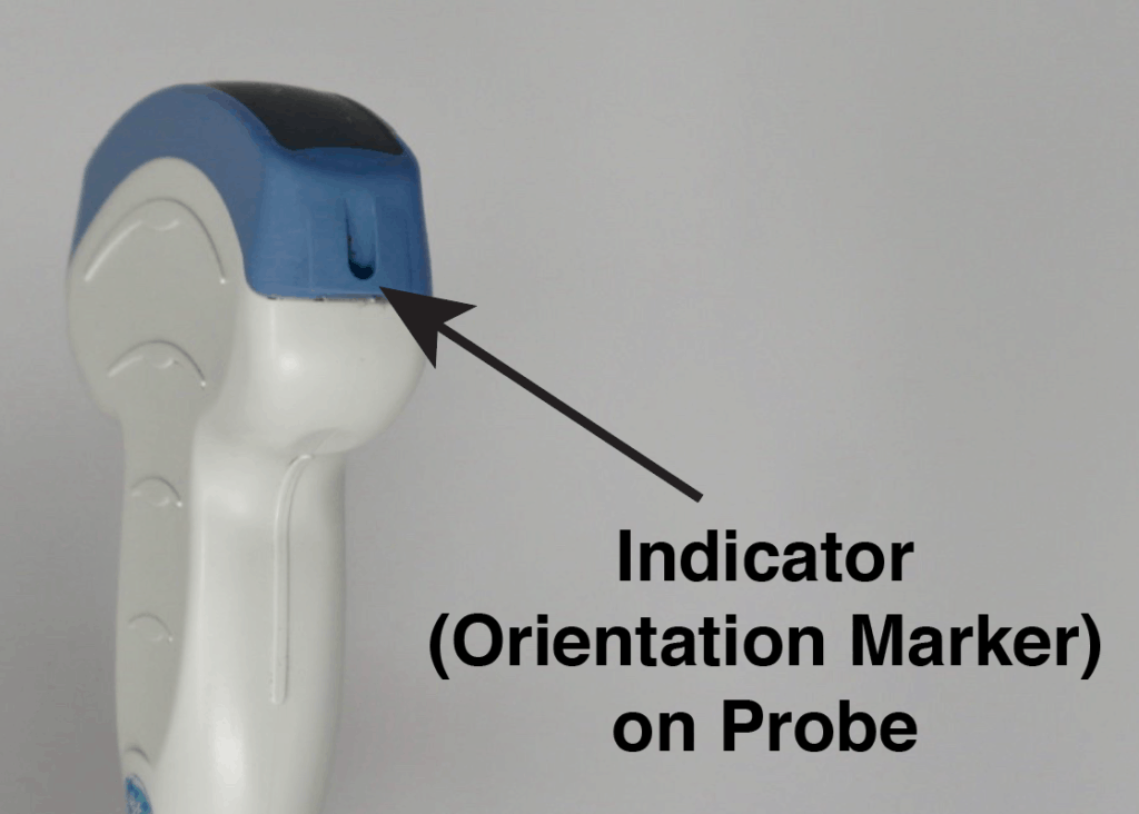Indicator Orientation Marker on Ultrasound Probe