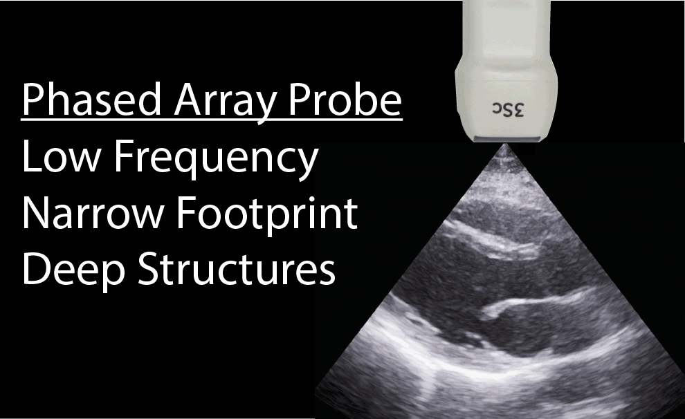 Phased Array Ultrasound Probe