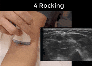 Ultrasound Movement - Rocking