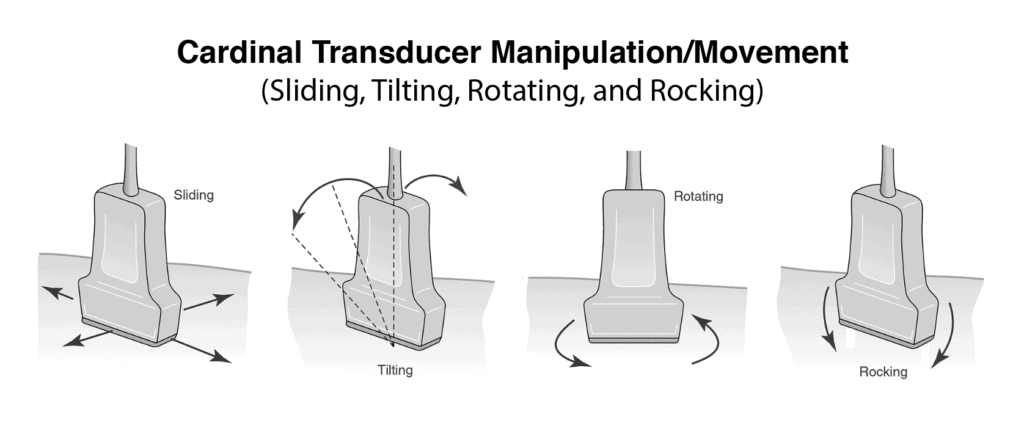 Ultrasound Transducer Movement Manipulation - Slide, Tilt, Rotate, Rock