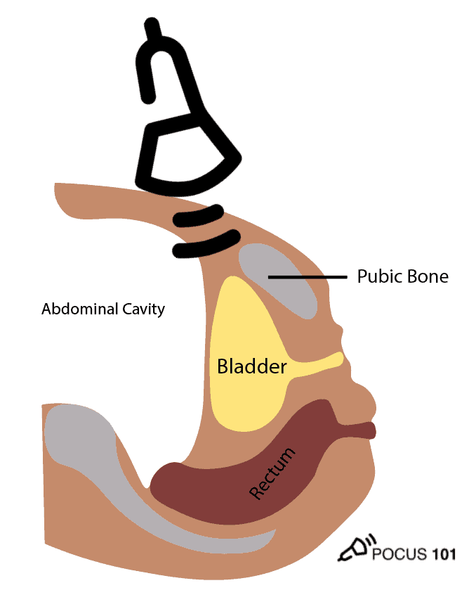 Bladder Ultrasound Pelvic Anatomy Illustration