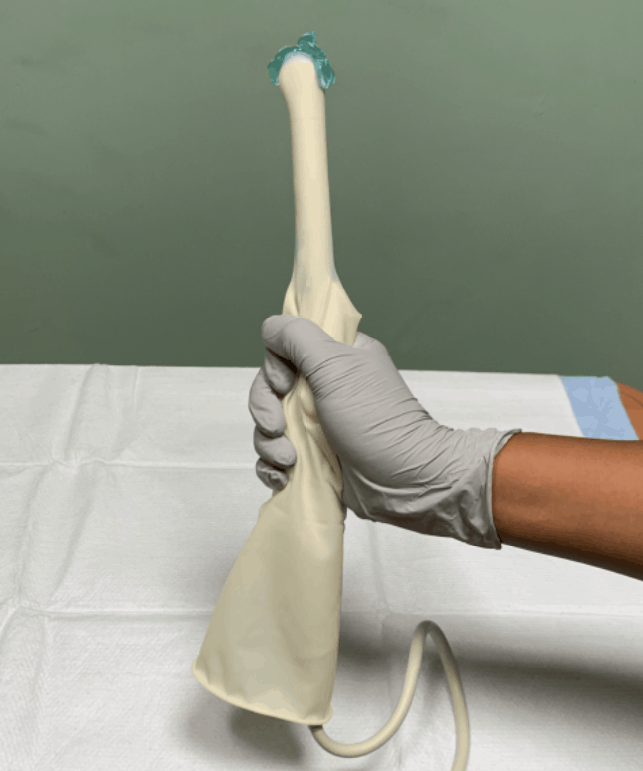 Endocavitary Transvaginal Ultrasound Probe Gel with Sterile Glove Condom Cover