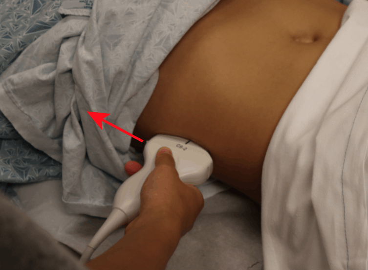 Renal Ultrasound Right Kidney Hand Position