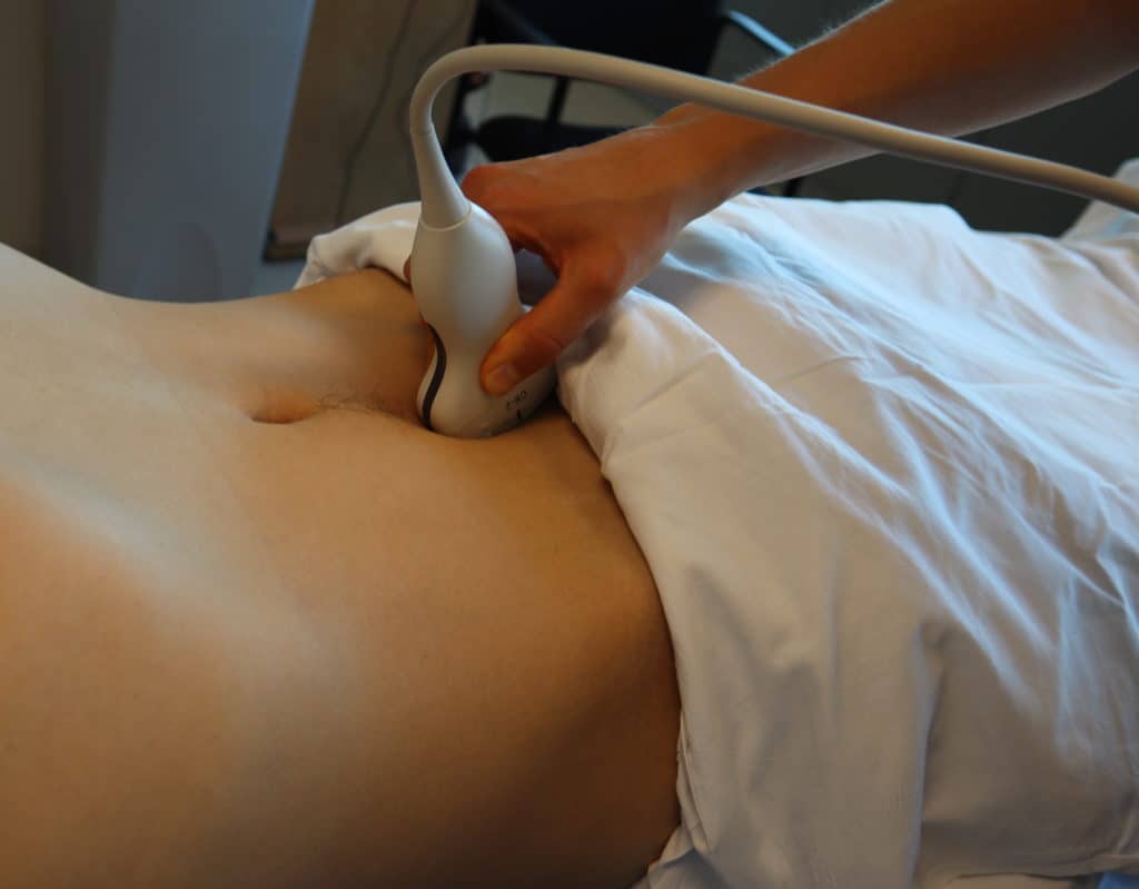 Sagittal-Longitudinal View Bladder Ultrasound Probe Position