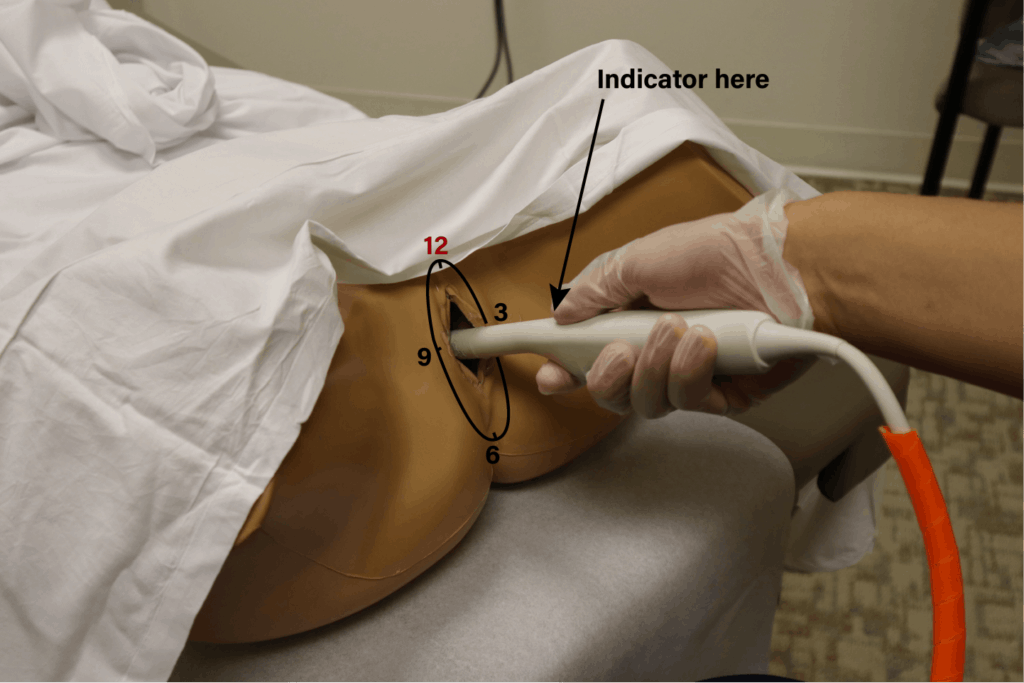 Transvaginal Ultrasound Probe Position Sagittal