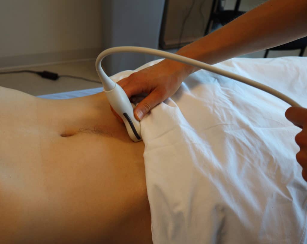 Transverse View Bladder Ultrasound Probe Position