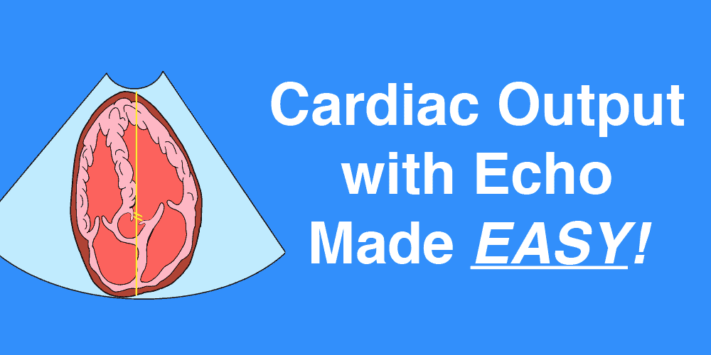 Cardiac Output with Echocardiography Echo Cardiac Ultrasound Made Easy