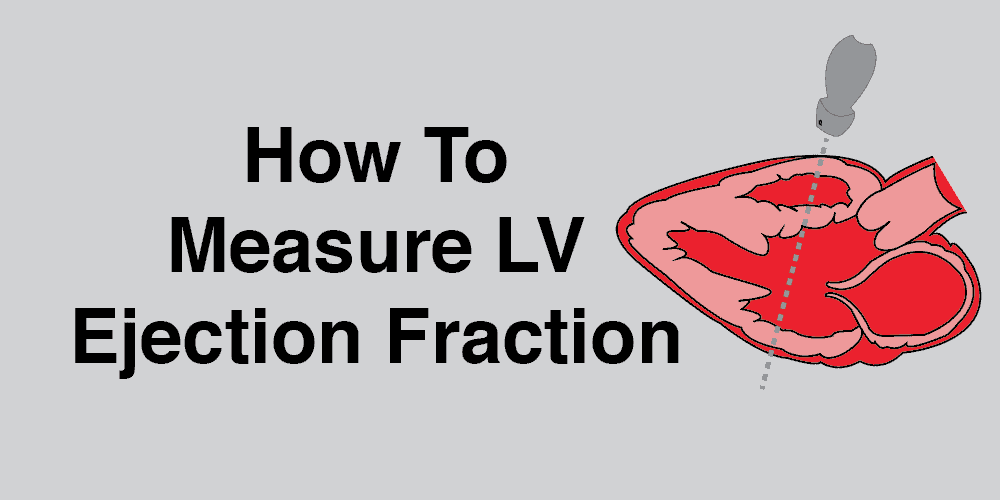 LV ejection fraction EF systolic function cardiac ultrasound echocardiography POCUS qualitative quantitative