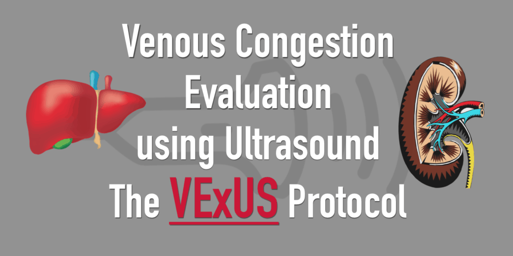 Venous Excess Ultrasound VExUS Score