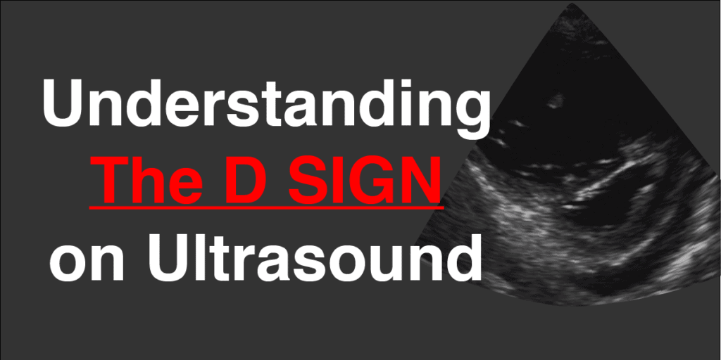 D Sign Ultrasound and Echocardiography