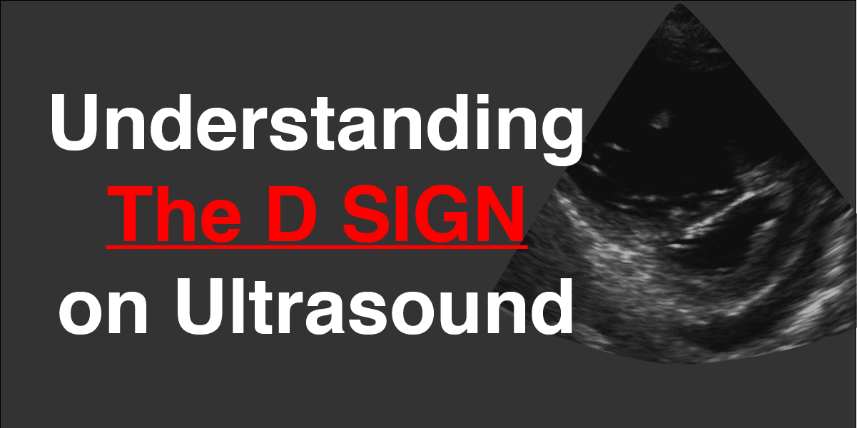 D Sign Ultrasound and Echocardiography