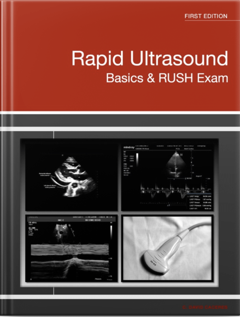 Rapid Ultrasound Basics and RUSH exam