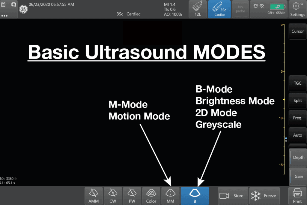 Basic Ultrasound Modes - B Mode & M Mode