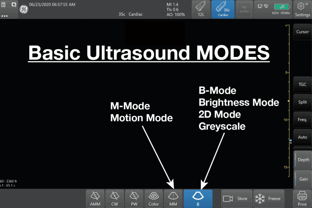 Modes Ultrasound A-mode- amplitude mode. B-mode- brightness mode. - ppt  video online download