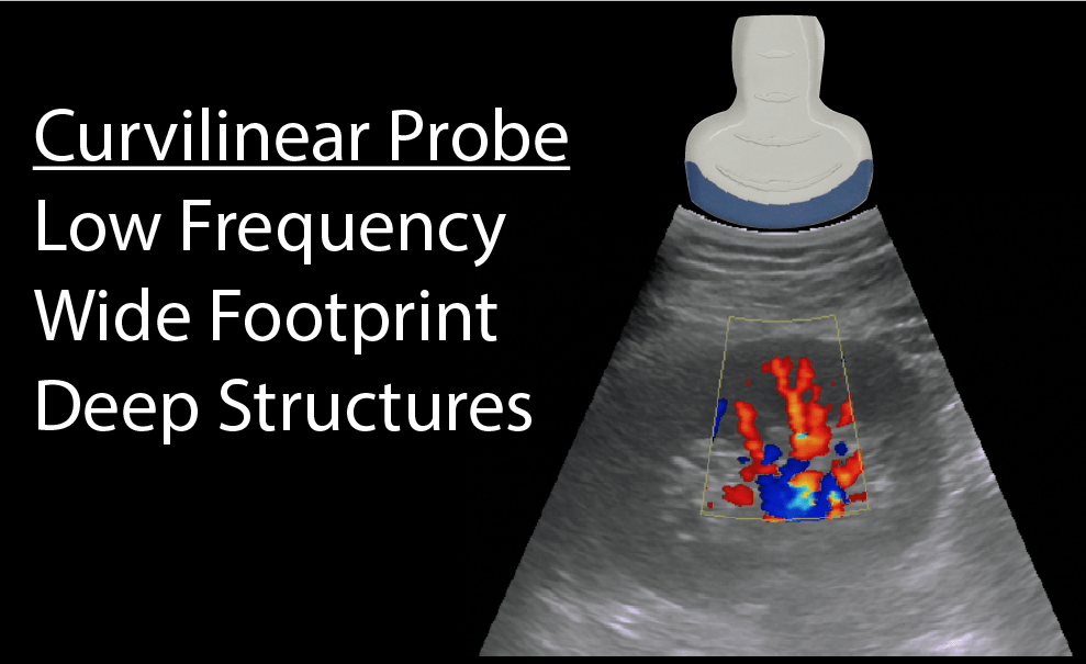 Curvilinear Ultrasound Probe