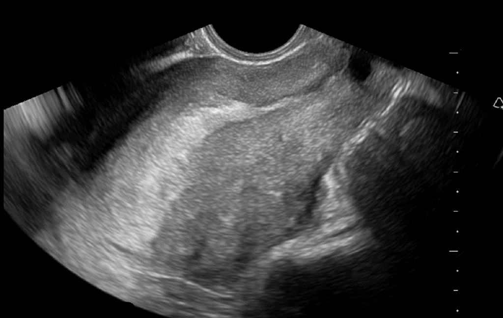 Ultrasound Machine Basics-Knobology, Probes, and Modes - POCUS 101