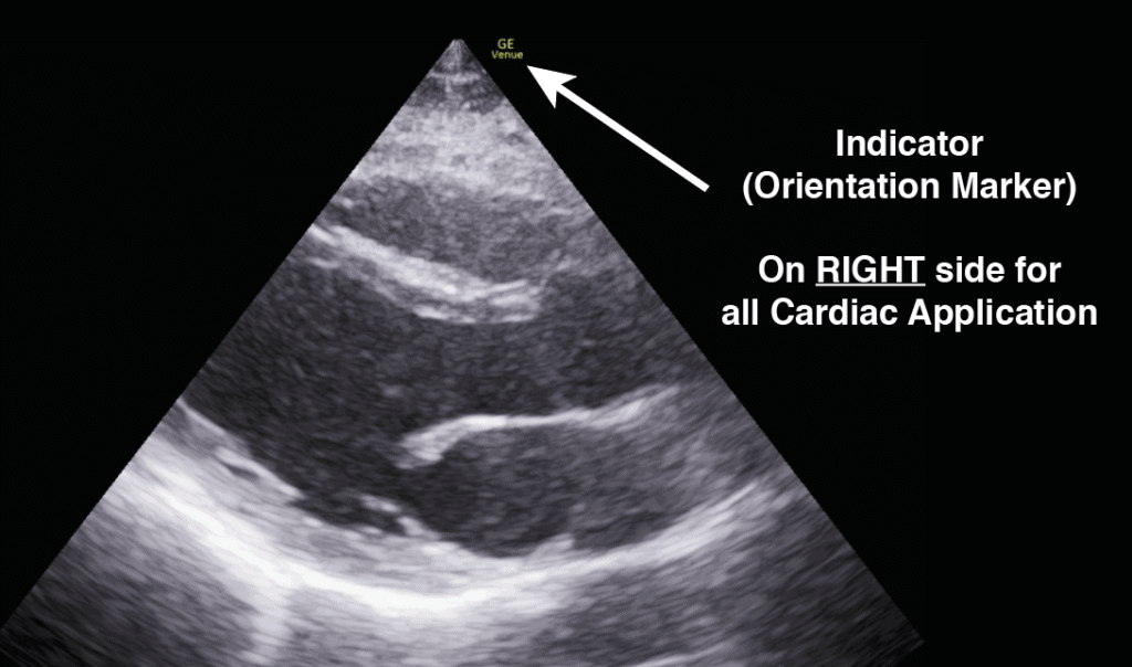 Indicator Orientation Marker for Cardiac
