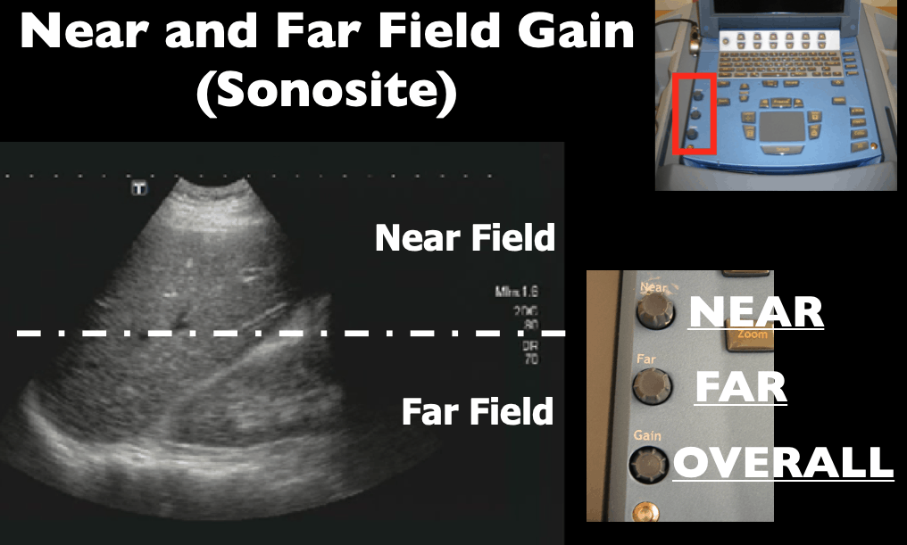 Ultrasound Machines - Knobology — Taming the SRU