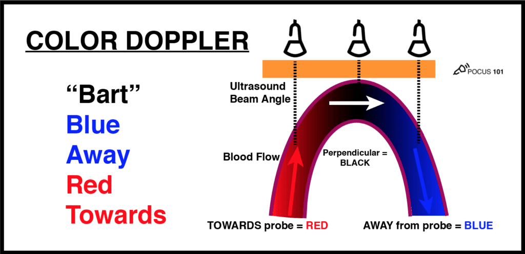 Ultrasound Color Doppler BART