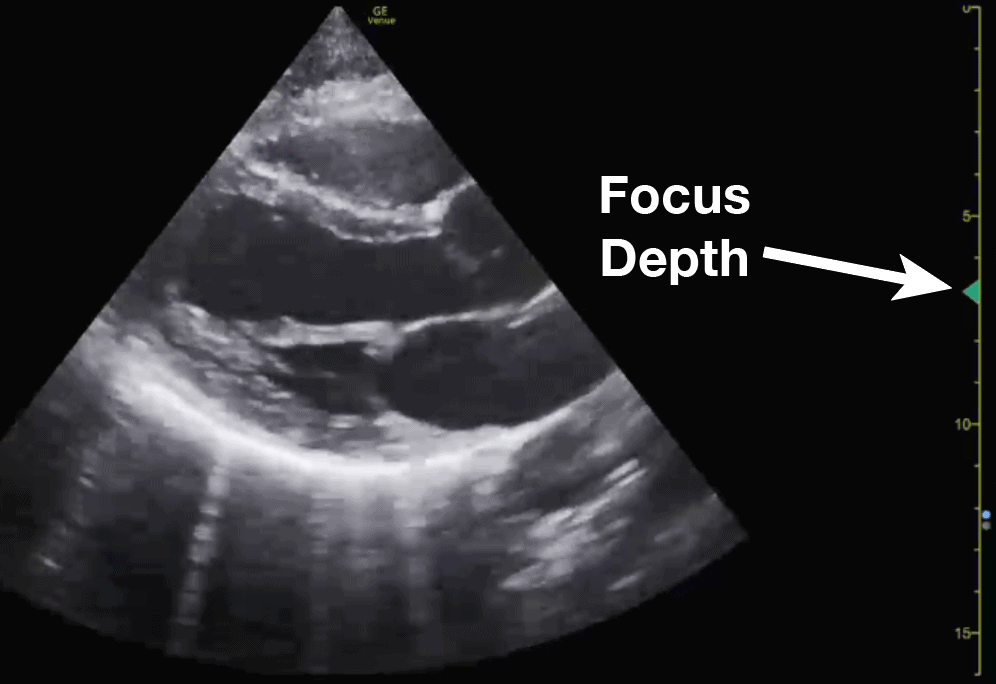 Ultrasound Machine Basics-Knobology, Probes, and Modes - POCUS 101