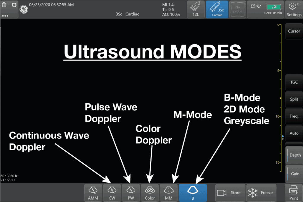Ultrasound Modes - B Mode, M Mode, Color, PW, CW Doppler