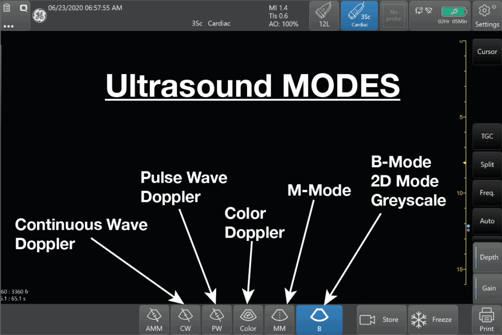 B-mode ultrasound gave us images