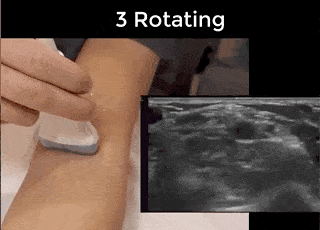 Ultrasound Movement - Rotating