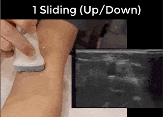Ultrasound Movement - Sliding