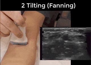 Ultrasound Movement - Tilting