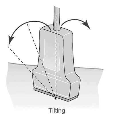 Ultrasound Movement - Tilting