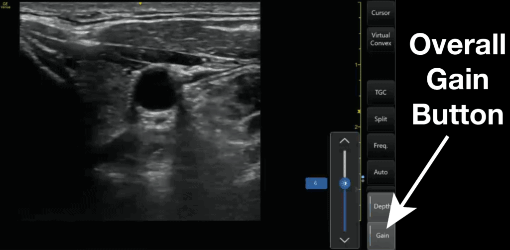 Ultrasound Overall Gain Button