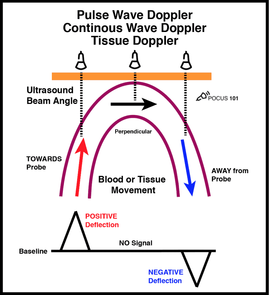 Ultrasound Physics Basics - Pulse Wave, Continuous Wave, Tissue Doppler
