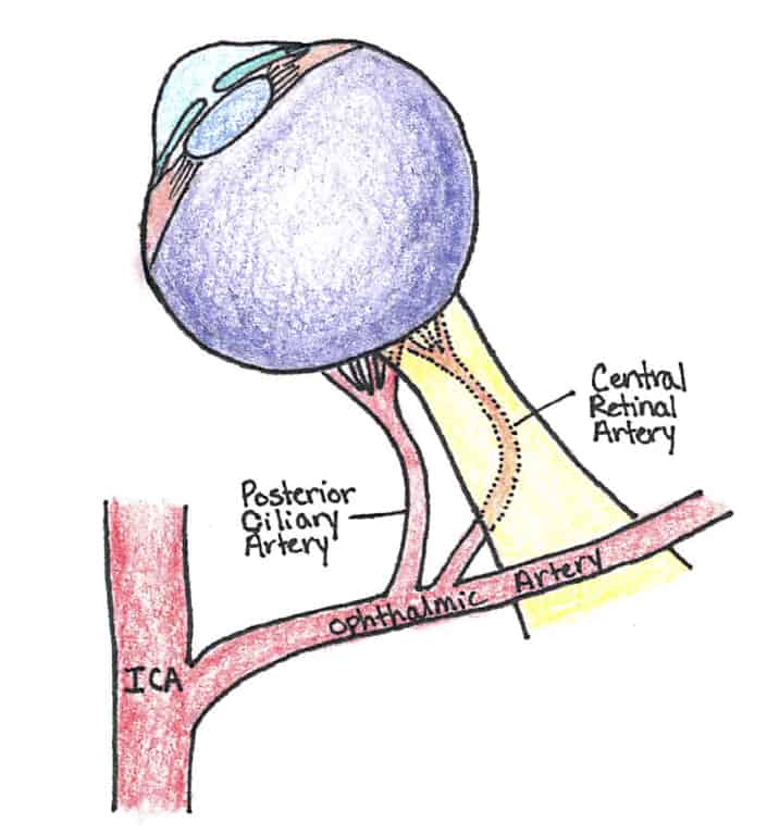 Central Retinal Artery Occlusion Illustration