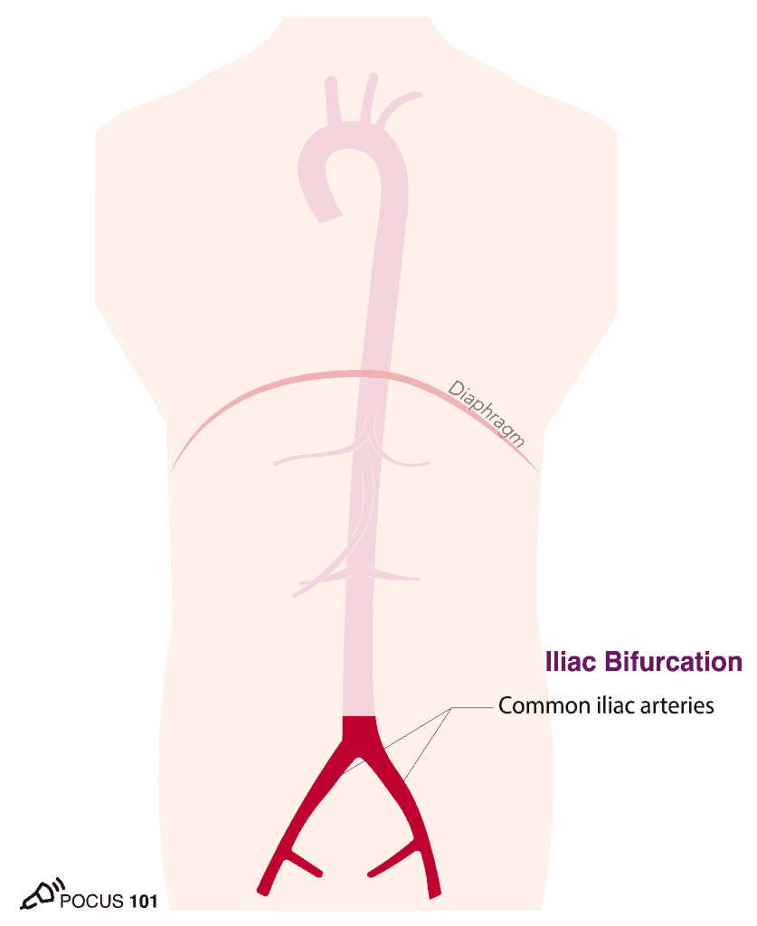 Aorta Aortic Bifurcation Illustration