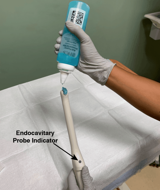 Endocavitary Transvaginal Ultrasound Probe Gel
