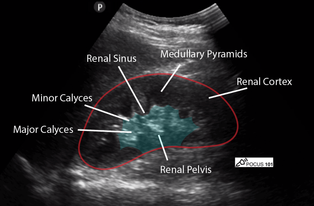 Renal Kidney Ultrasound Labeled - Normal Longitudinal View