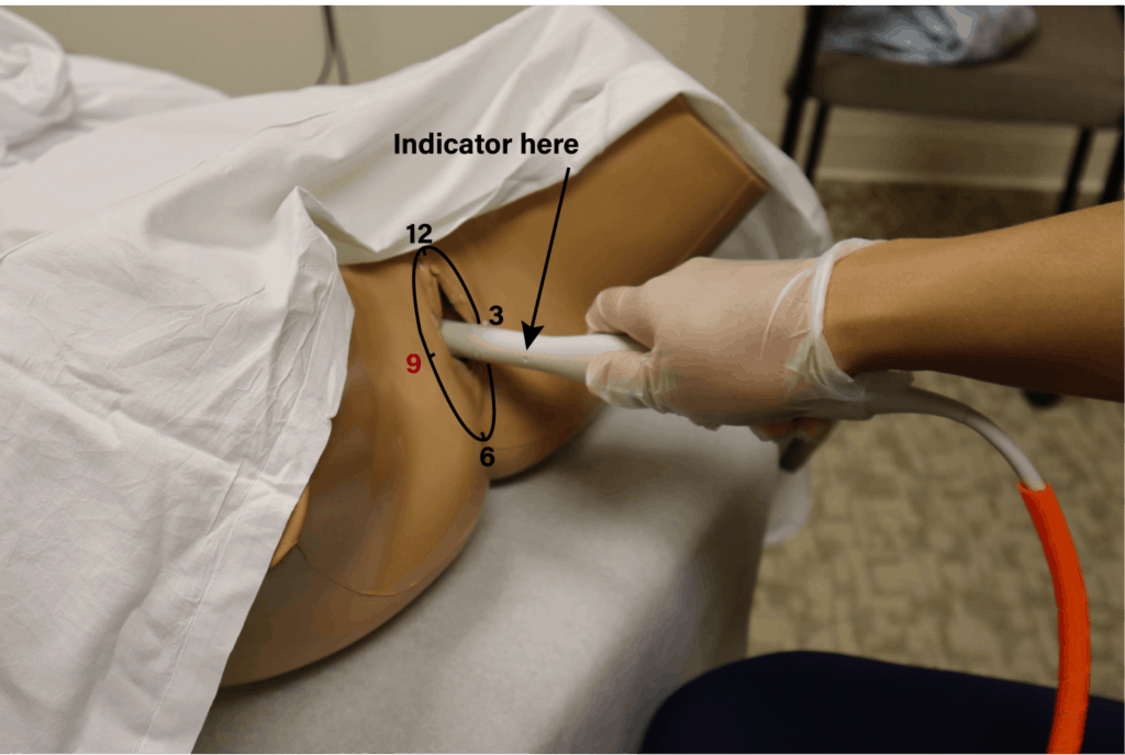 Transvaginal Ultrasound Probe Position Transverse