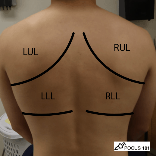 Lung Surface Anatomy - Posterior