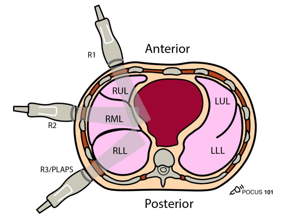 Lung Ultrasound Probe Positioning - Transverse View