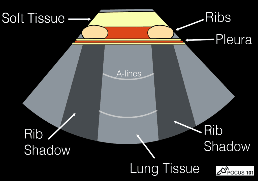 EASYSONIC BAC À ULTRASONS