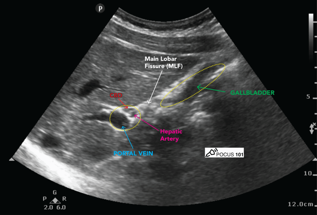 hepatic artery ultrasound