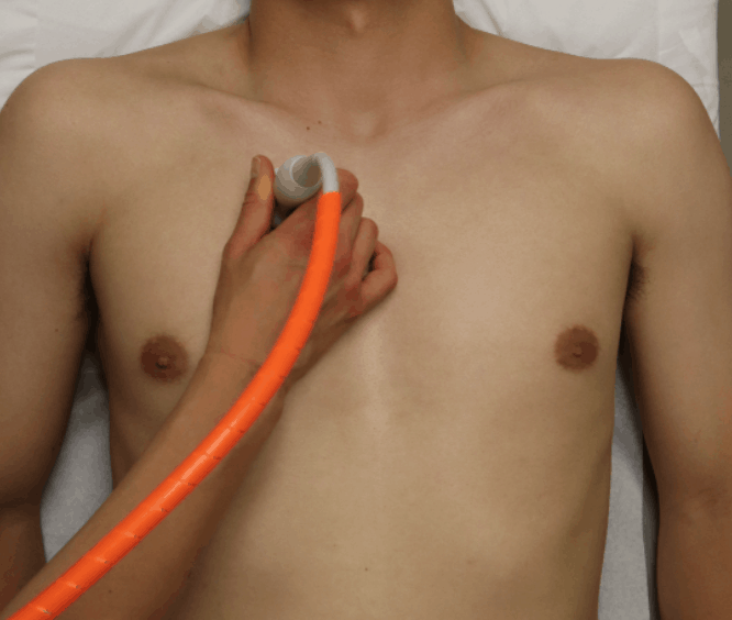 R1 Point - Lung Ultrasound Midclavicular Line