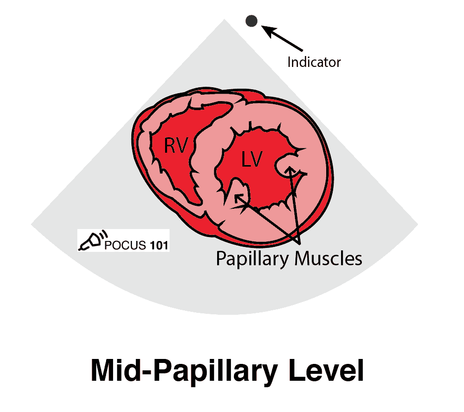 Cardiac Ultrasound Echocardiography Parasternal Short Axis View PSSA PSAX Mid Papillary Illustration