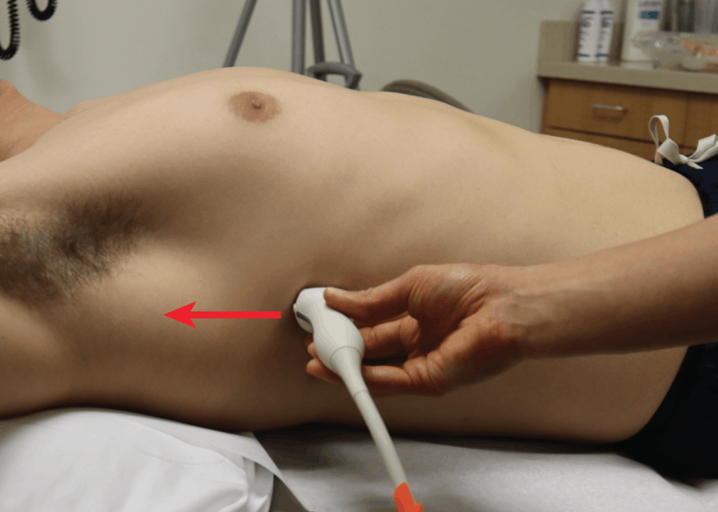 Probe position and normal images obtained during E-FAST examination.