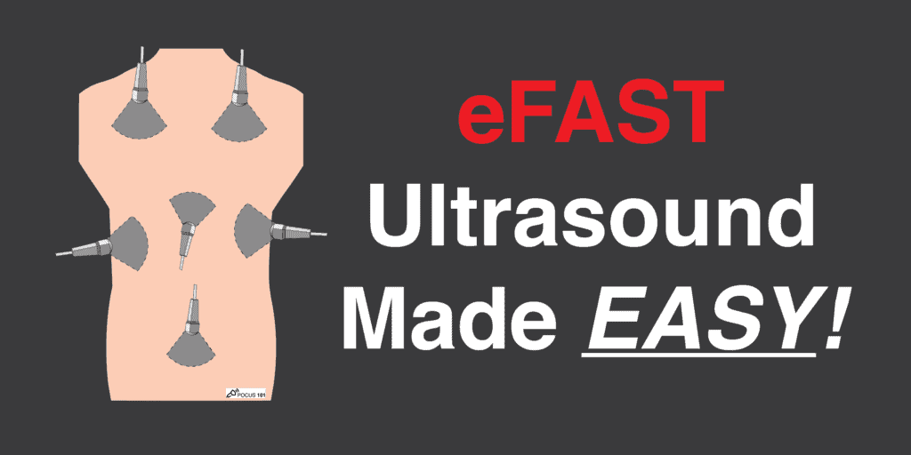 eFAST FAST Ultrasound Exam Featured Image