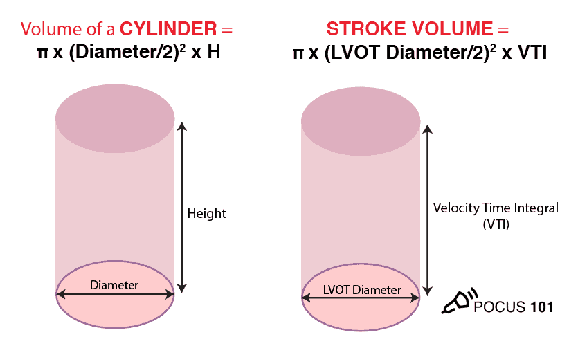 Stroke Volume Cylinder formula Illustration Echocardiography Cardiac Output Ultrasound