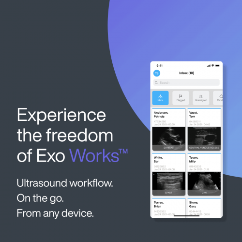 Exo Works Ultrasound Workflow